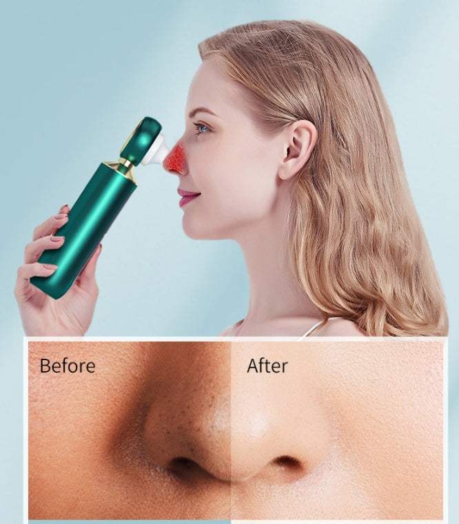 Blackhead Remover Device for Clear Skin